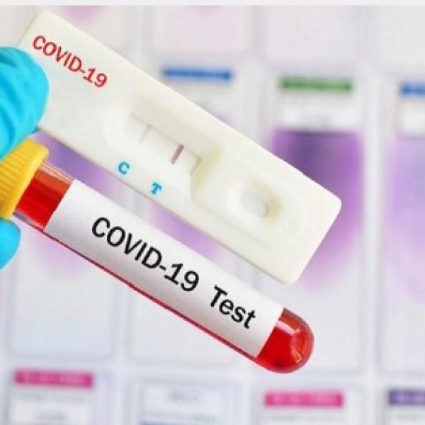 Cukup Tes Antigen, Pelajar Asal Kalbar Bisa Mudik, Ini Prosedurnya